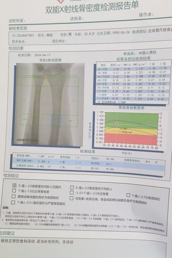 雙能X射線骨密度儀：準(zhǔn)確測(cè)量骨密度，助力骨質(zhì)疏松防治，守護(hù)骨骼健康